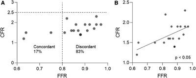 Particularities of coronary physiology in patients with atrial fibrillation: insights from combined pressure and flow indices measurements